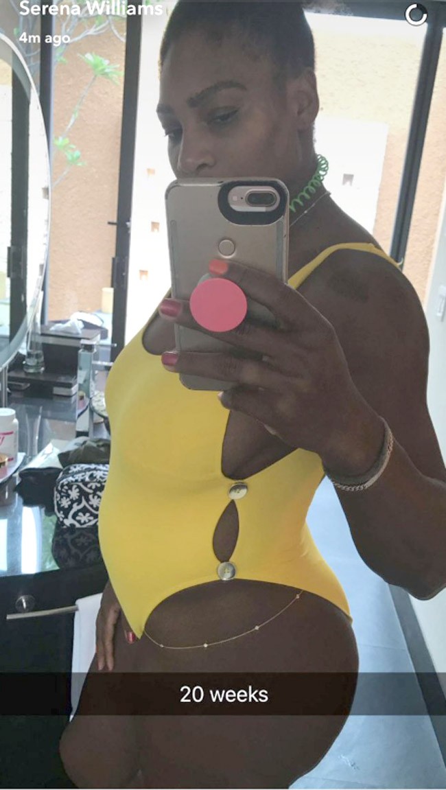 Serena Williams 