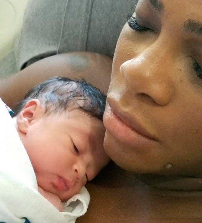 Serena Williams presenta a su hija: "Fue un parto complicado"