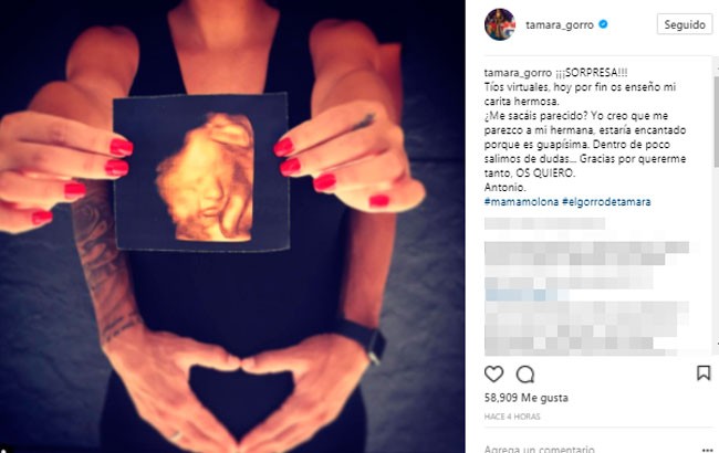Tamara Gorro muestra la primera imagen del rostro de su futuro hijo, Antonio