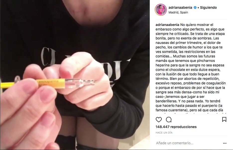 adriana-ha-compartido-en-instagram-un-video-muy-sincero