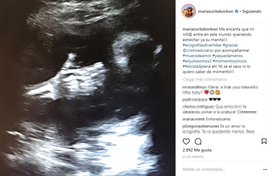 desplazamiento-de-placenta