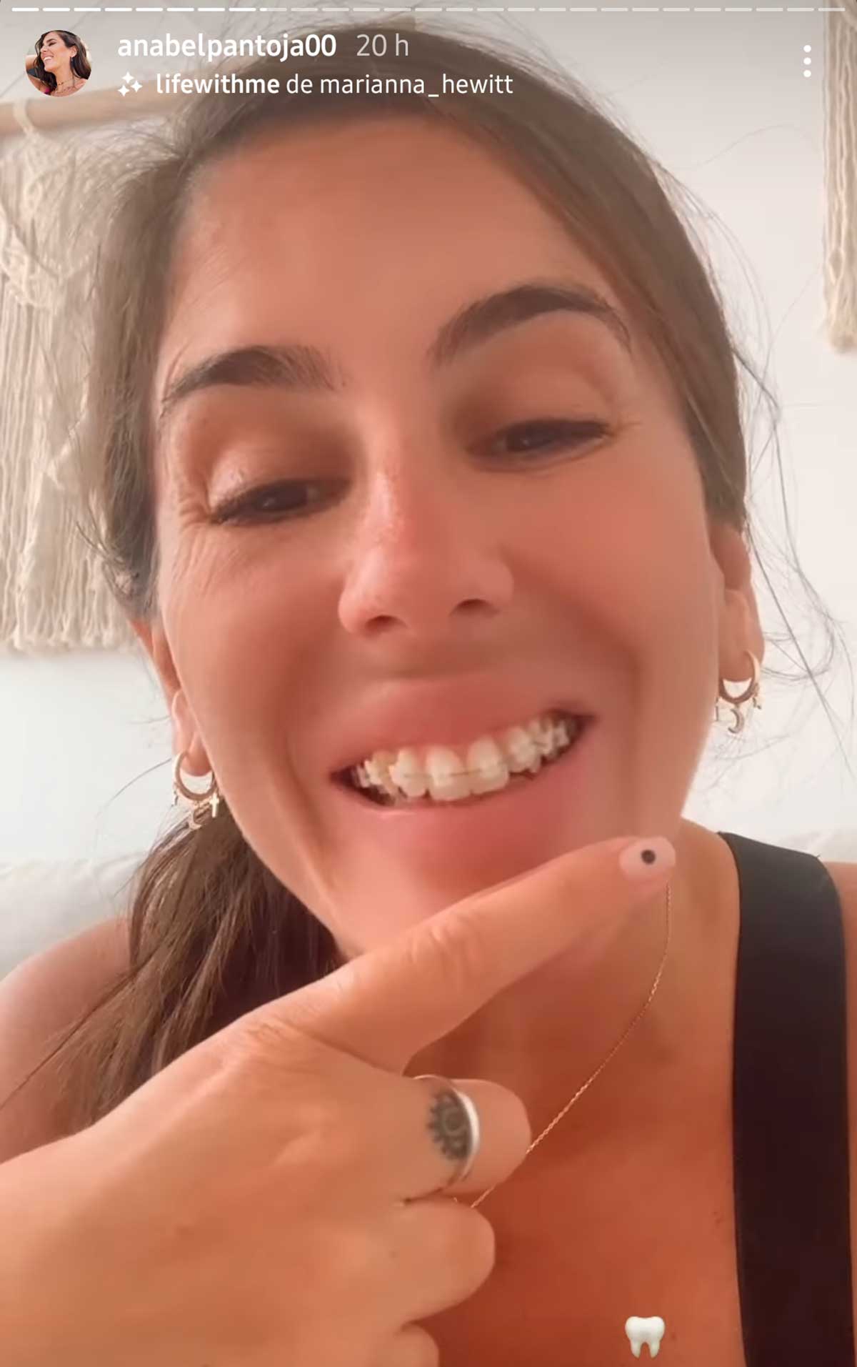 Anabel Pantoja da el paso por fin y se pone aparatos en los dientes: esta es su nueva sonrisa