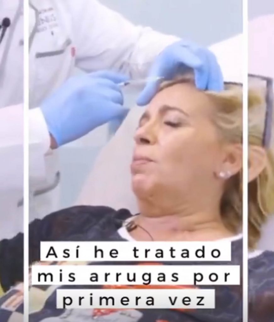 Carmen Borrego confiesa su último retoque facial