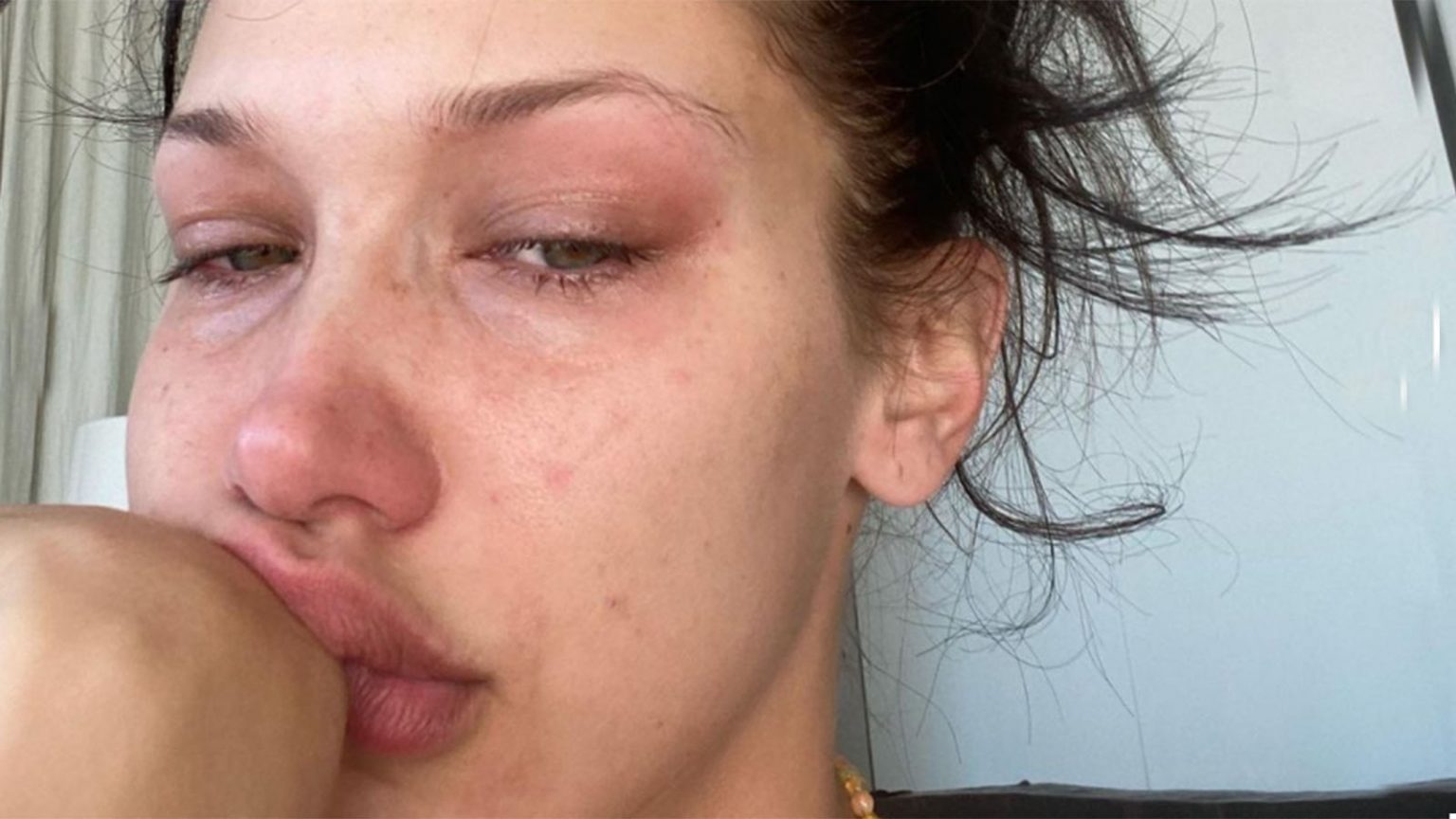 Las fotos de Bella Hadid llorando cada noche por su problema de salud mental (y el motivo)