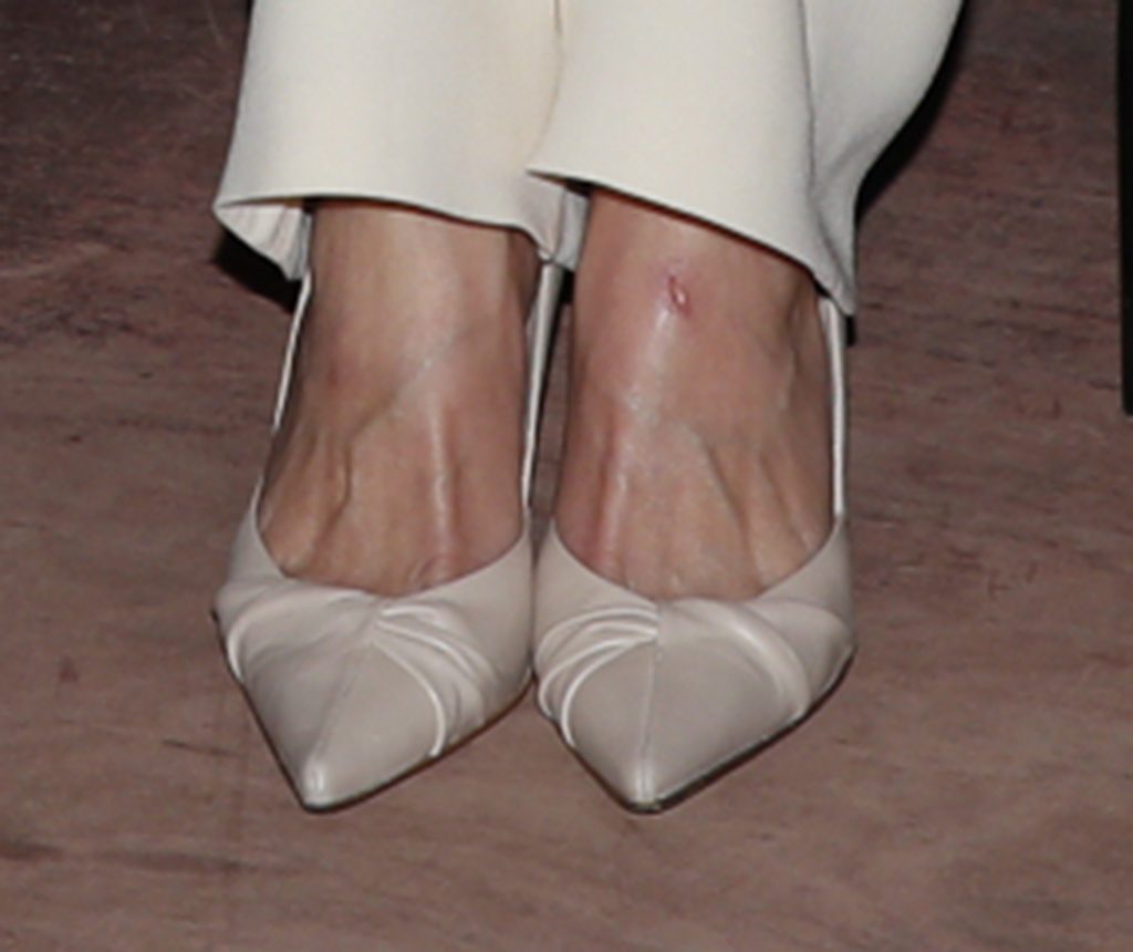 La sospechosa herida en el pie izquierdo de la Reina Letizia