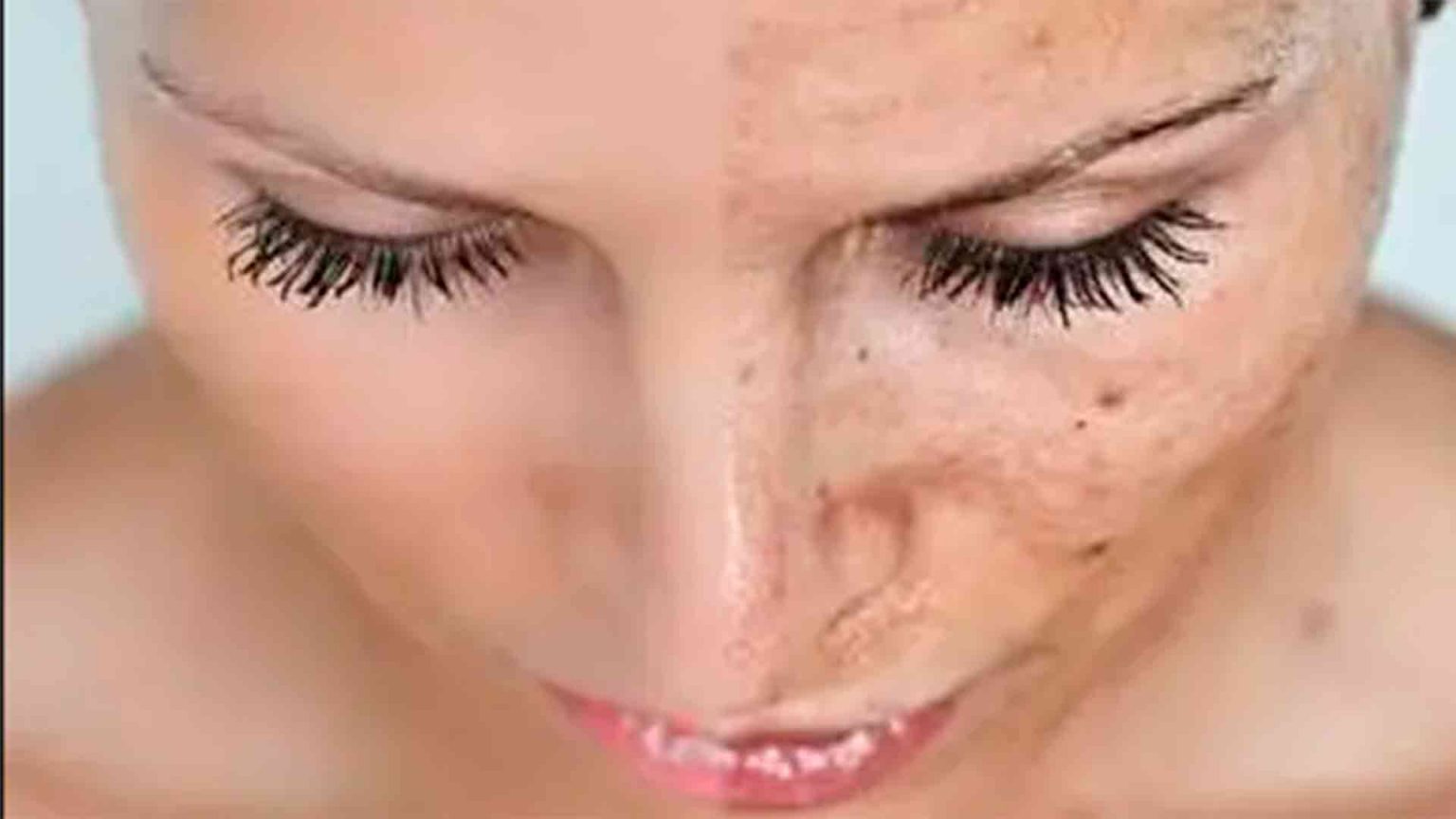 Los mejores peeling para renovar tu piel  