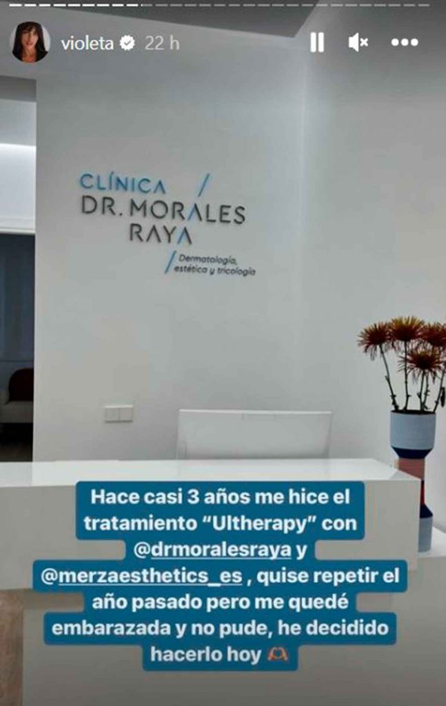 El tratamiento de Violeta Mangriñán para reafirmar la piel (sin pasar por quirófano)