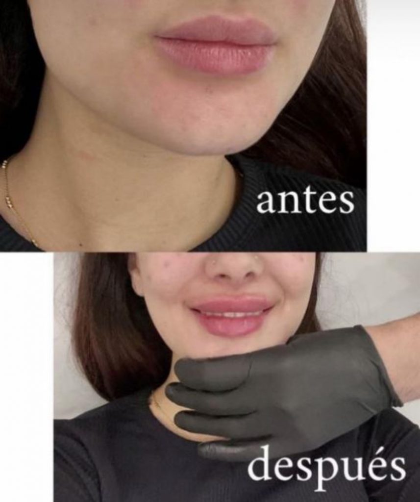Julia Janeiro retoque labios