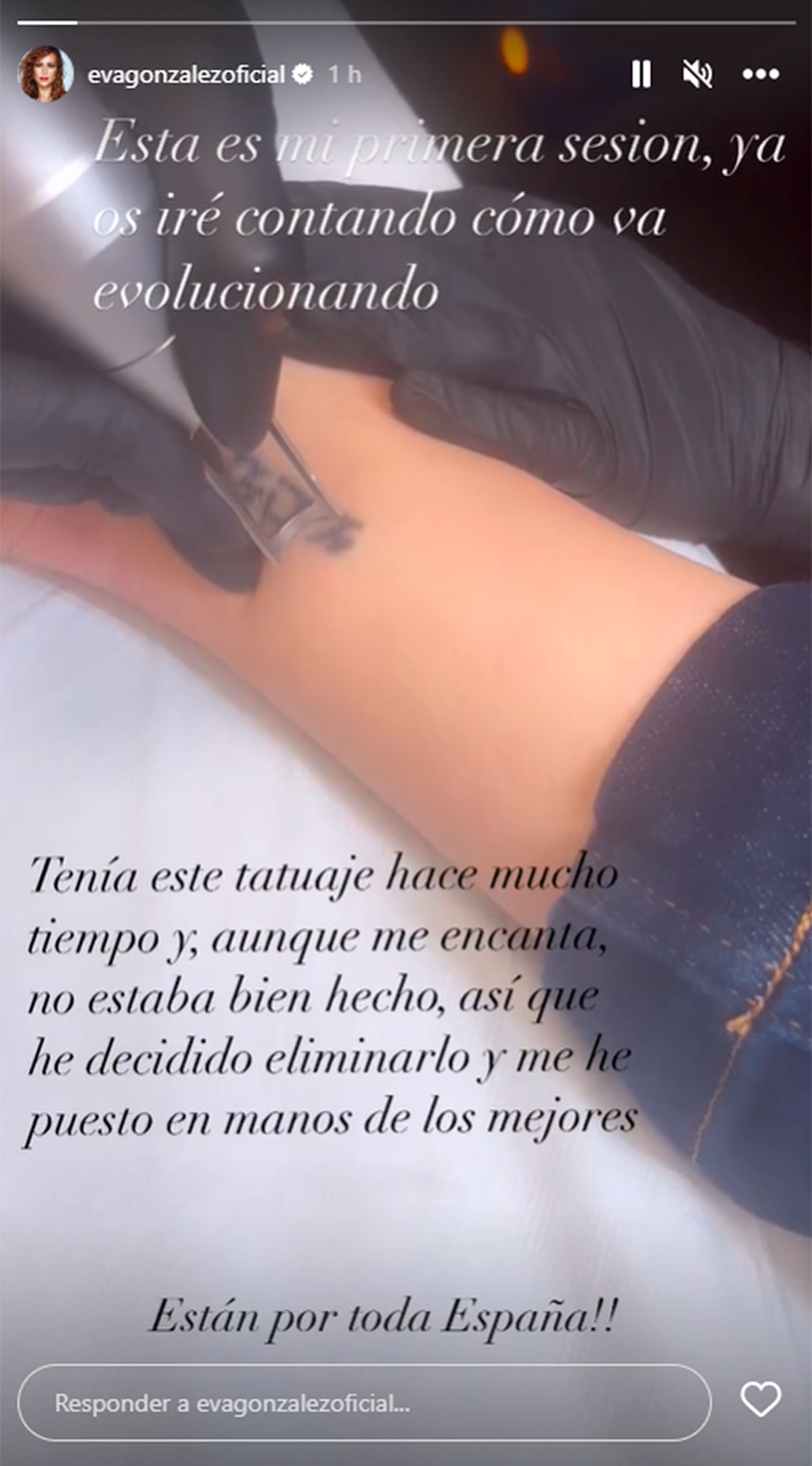 Eva González elimina de su cuerpo un tatuaje especial para ella