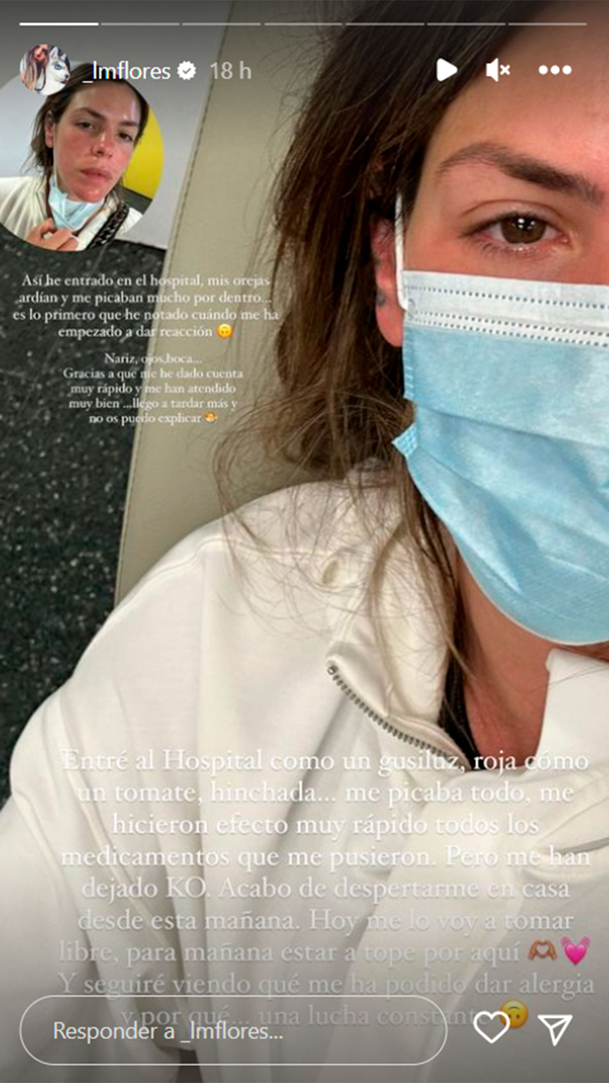 Laura Matamoros, en urgencias por culpa de una reacción alérgica