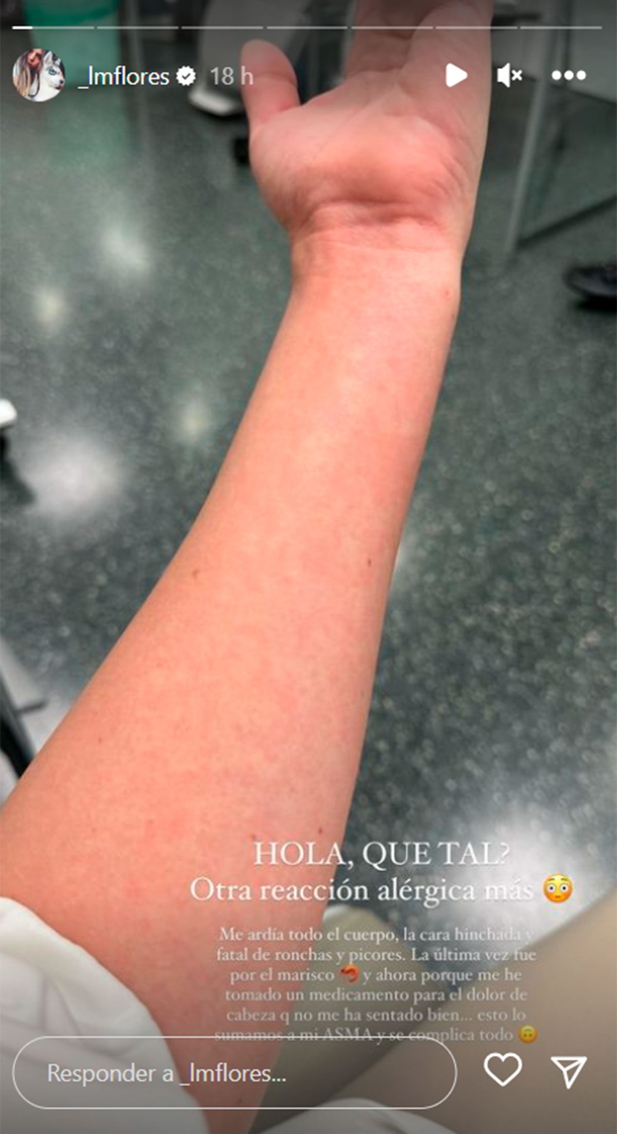 Laura Matamoros, en urgencias por culpa de una reacción alérgica