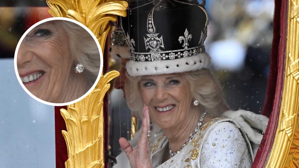 Analizamos la piel de Camilla, reina de Inglaterra: hablan los expertos