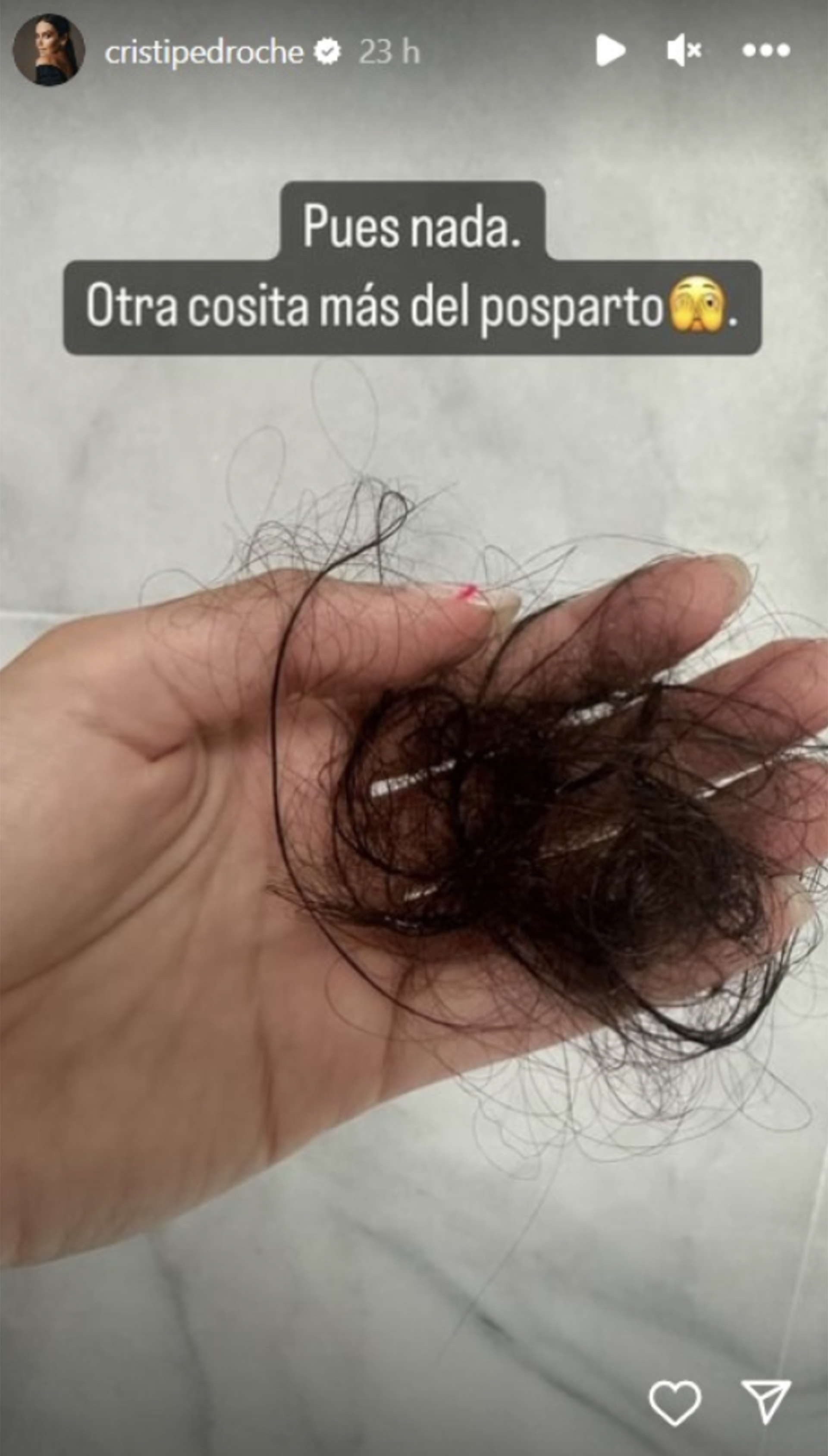 Storie de Cristina Pedroche sobre la caída de cabello.