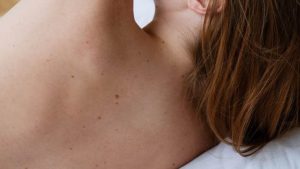 Una experta en belleza nos dice cómo acabar con las manchas del verano en la piel