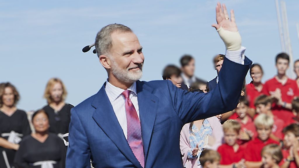 El Rey Felipe podría ser operado de su mano izquierda