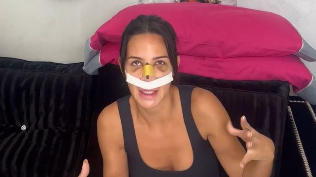 Tamara Gorro muestra el terrible estado de su cara tras la operación