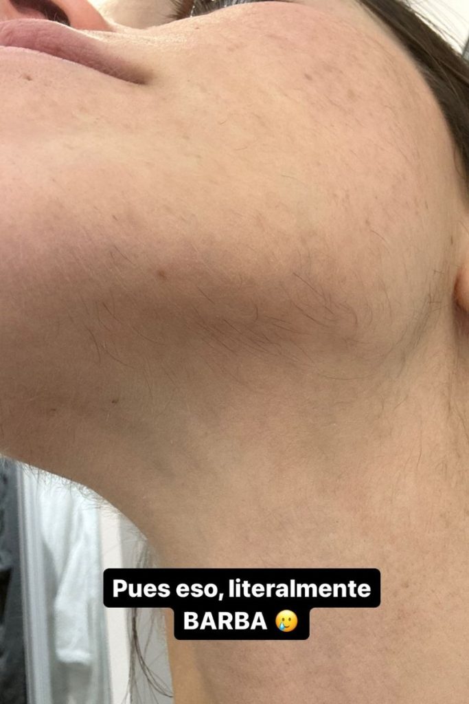 Violeta Mangriñán confiesa el problema de ‘barba’ que padece