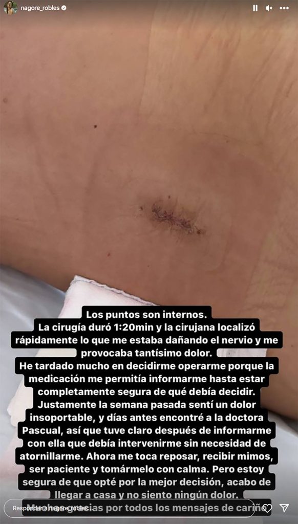 Nagore Robles muestra la cicatriz de su operación de espalda