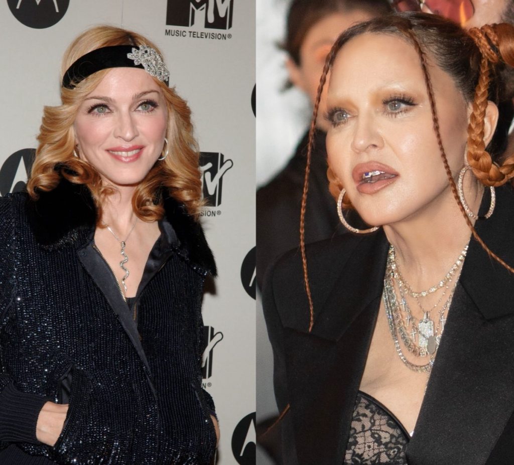 desastres estéticos famosas Madonna