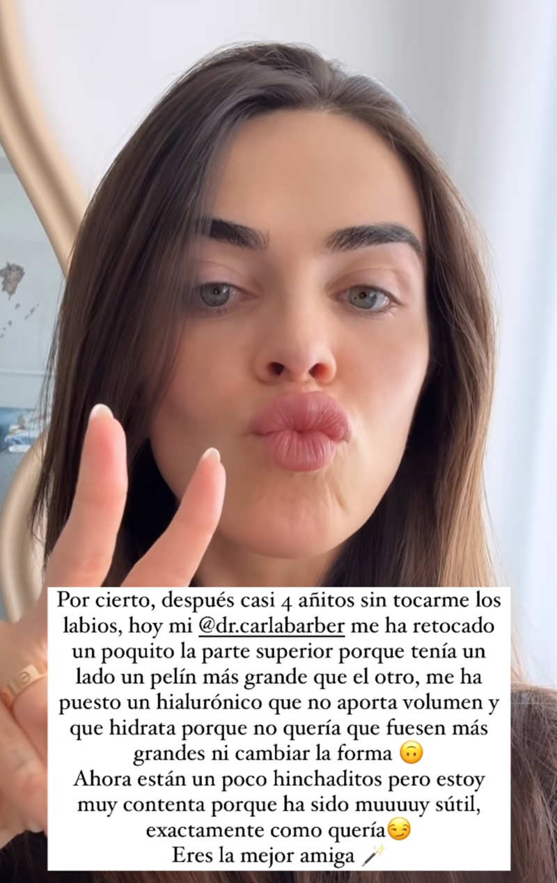 Violeta Mangriñán se retoca una vez más los labios con ácido hialurónico