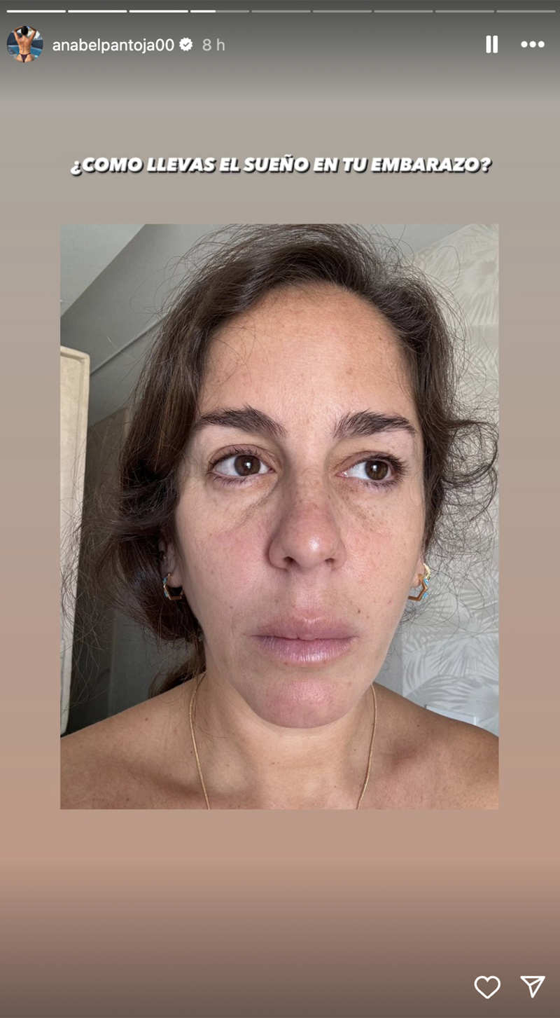 El selfie de Anabel Pantoja al despertarse