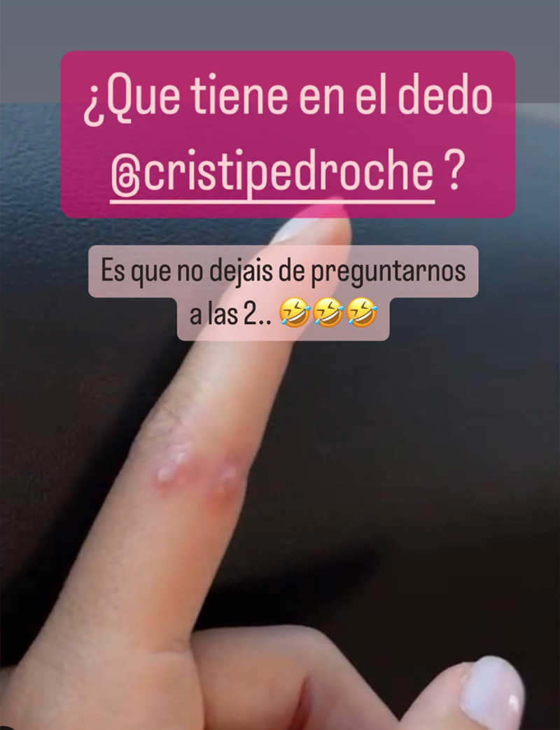 La infección de Cristina Pedroche