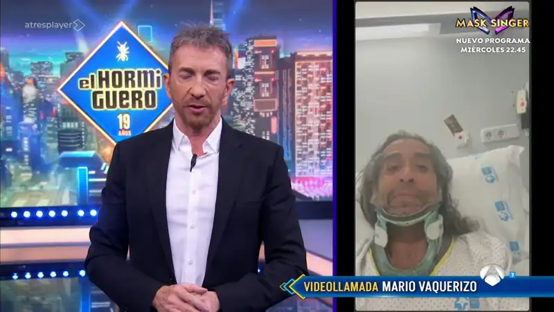 Mario Vaquerizo en 'EL hormiguero'