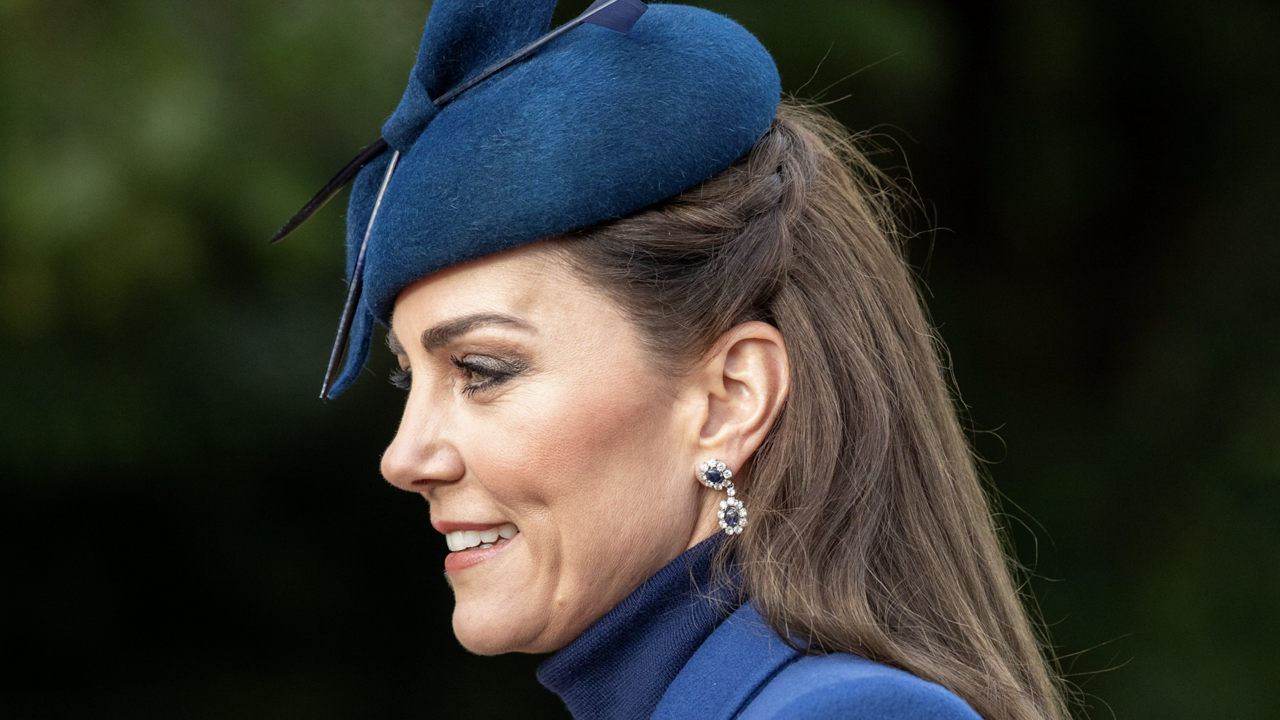 La operación de la que Kate Middleton nunca quiere hablar y que le dejó una cicatriz en la cabeza 