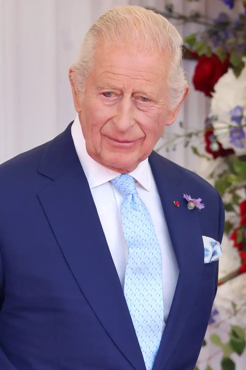 El Rey Carlos III presenta un derrame en su ojo