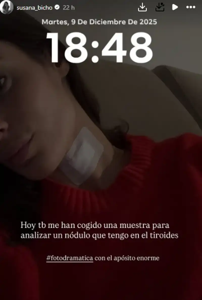 La historia de Susana Molina explicando su prueba médica